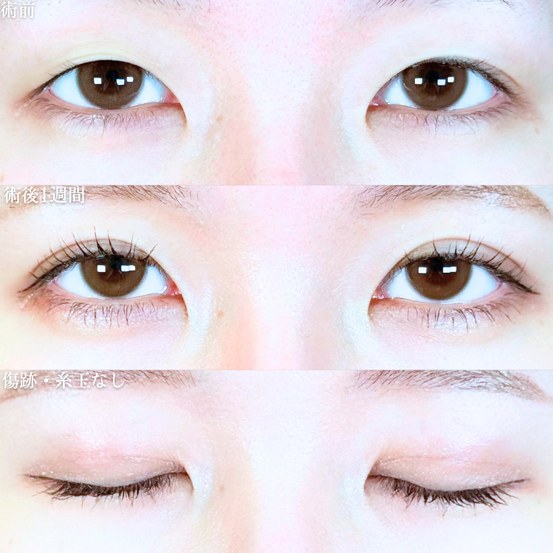 No.19978の症例写真