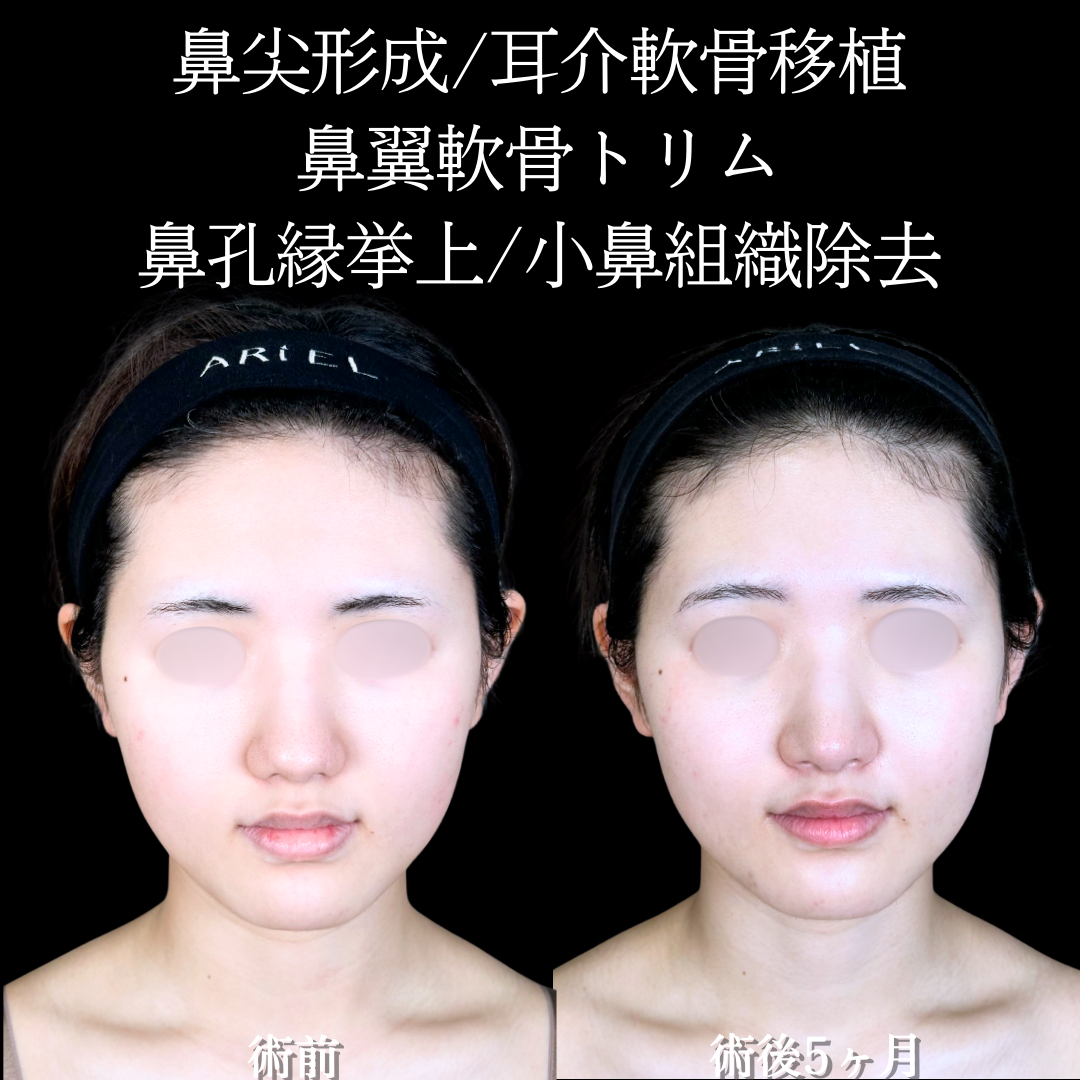 No.20066の症例写真2