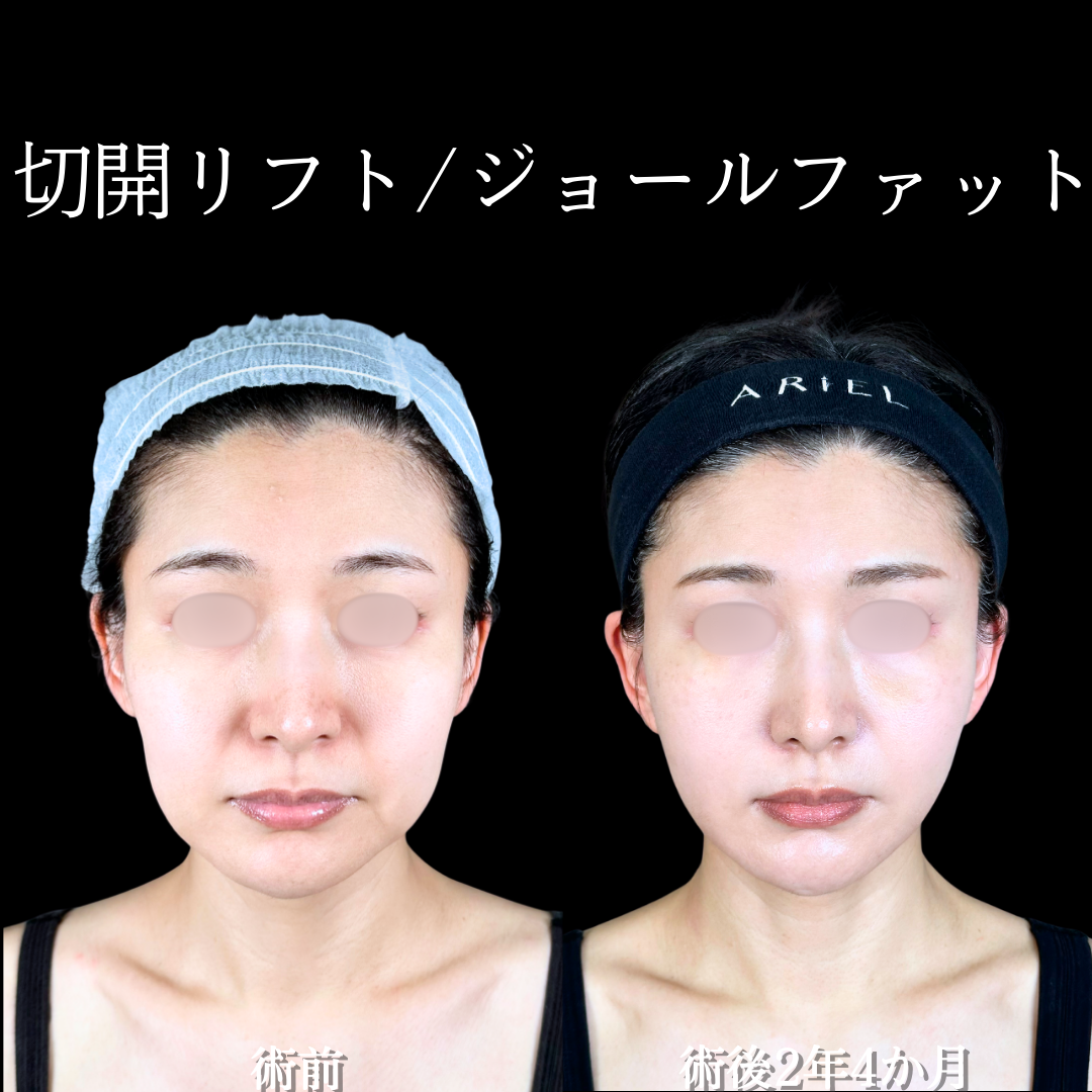 No.20082の症例写真2