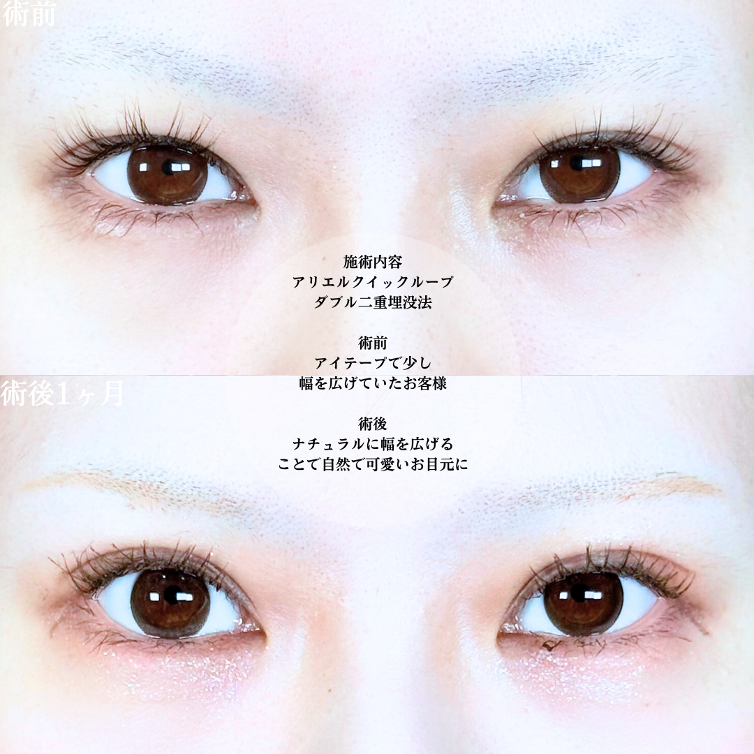 No.19927の症例写真1