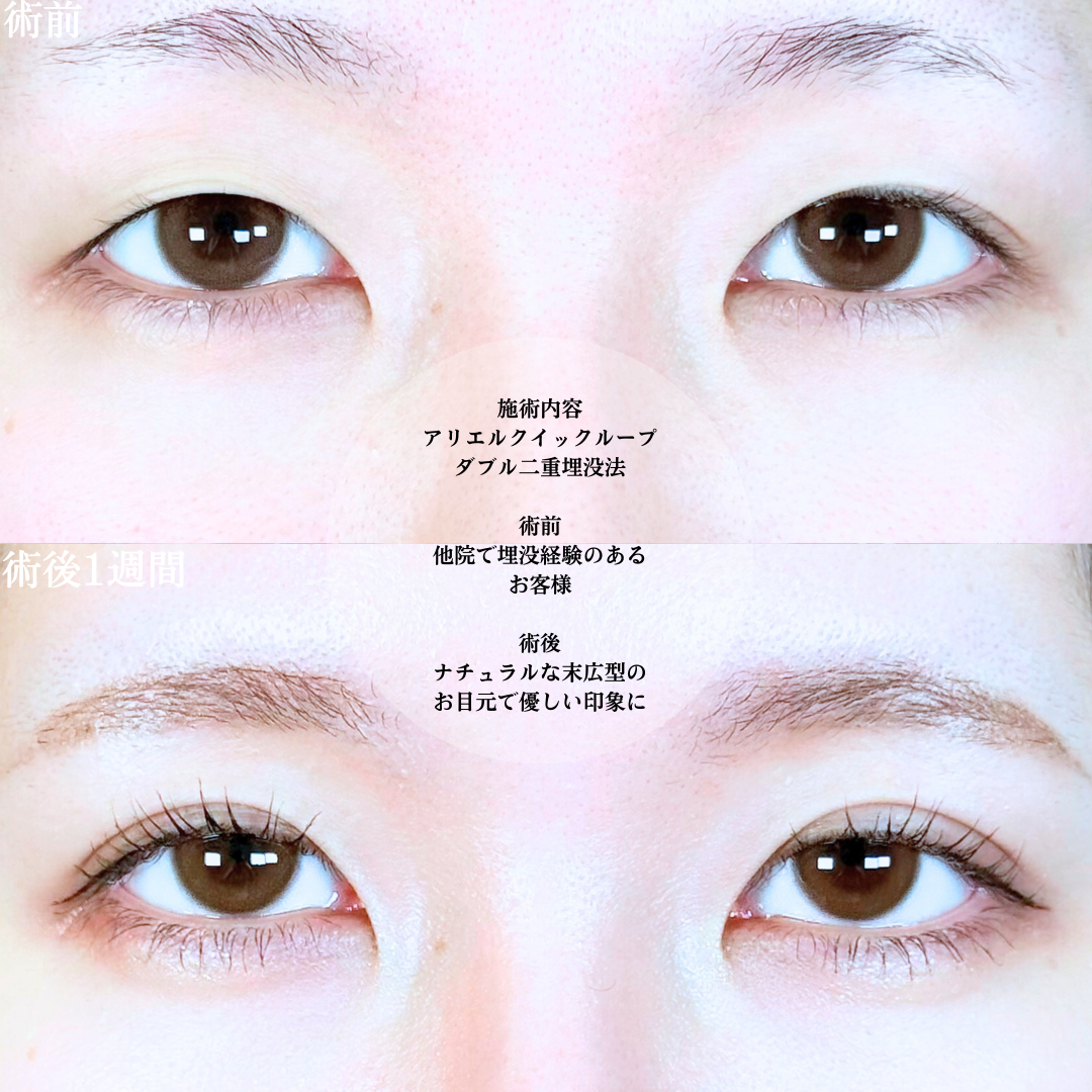 No.19978の症例写真1