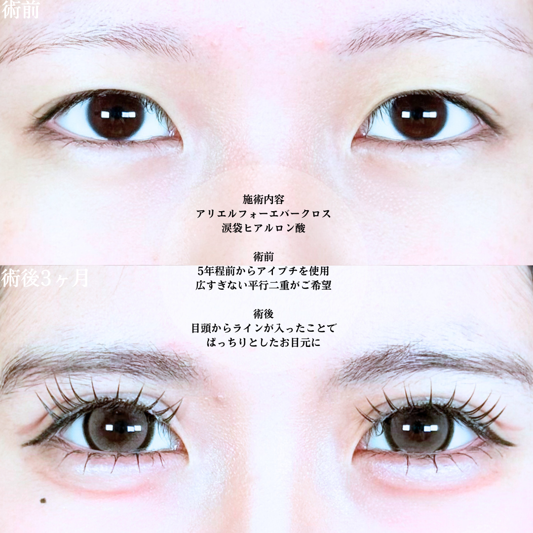 No.20090の症例写真1