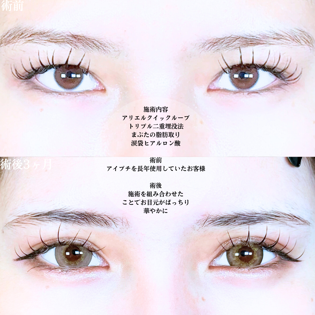 No.19874の症例写真1