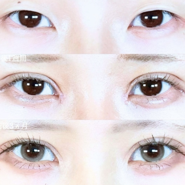 No.19917の症例写真