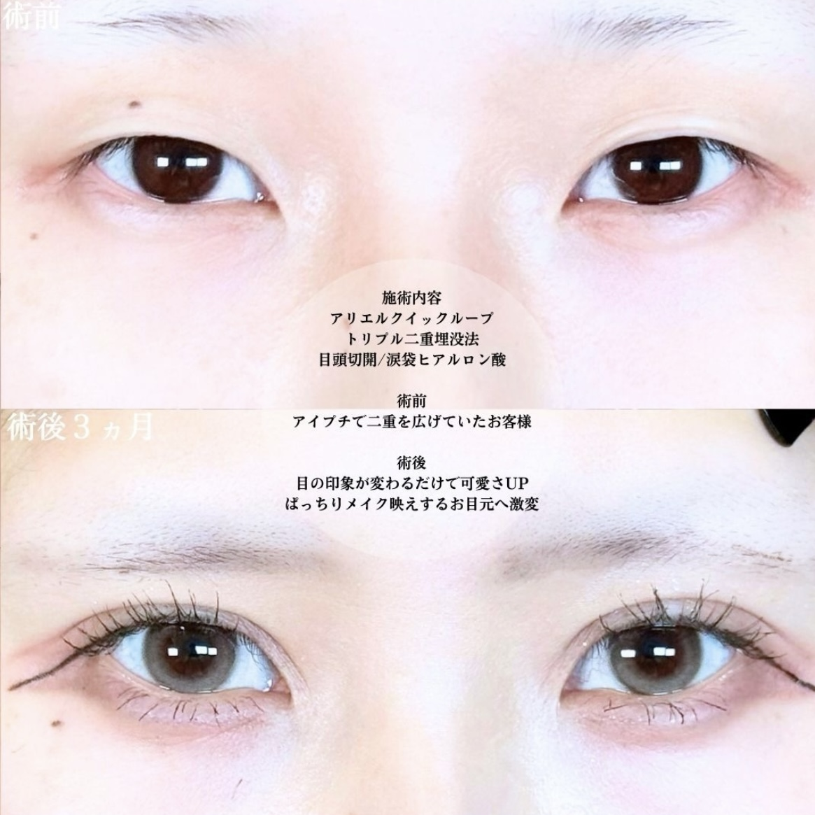 No.19917の症例写真1