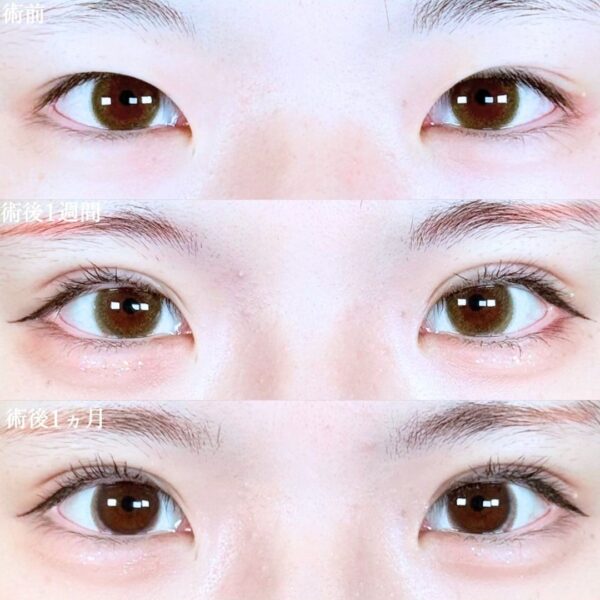 No.19911の症例写真