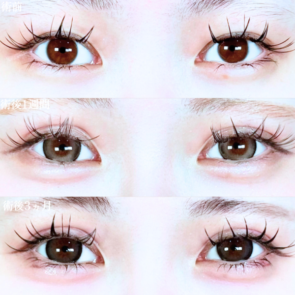 No.19816の症例写真