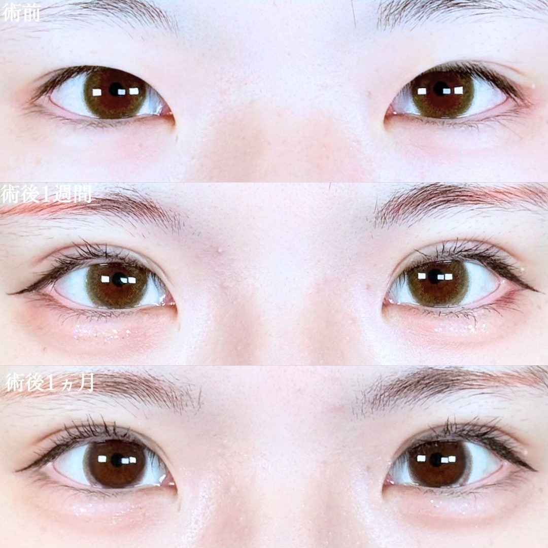 No.19911の症例写真