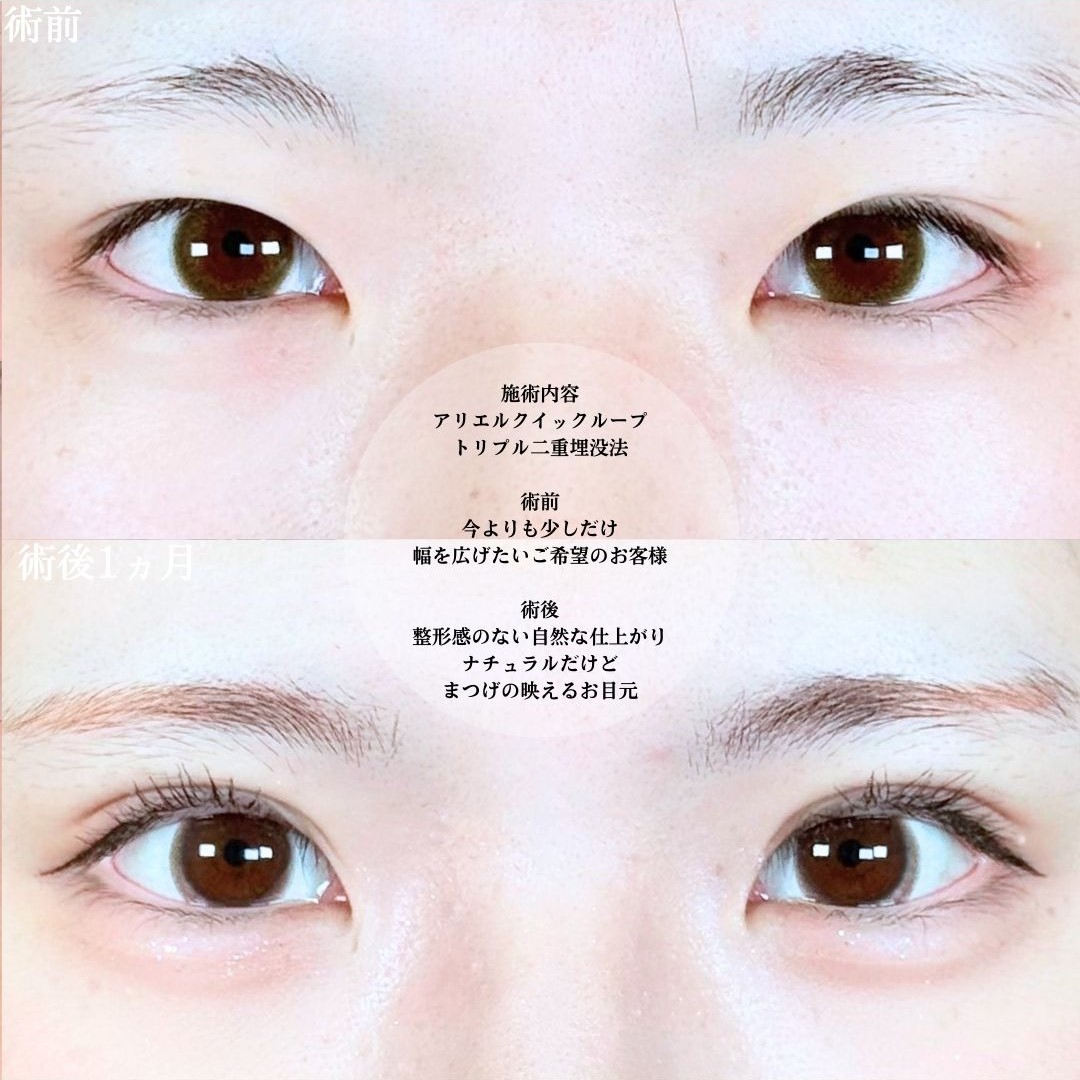 No.19911の症例写真1