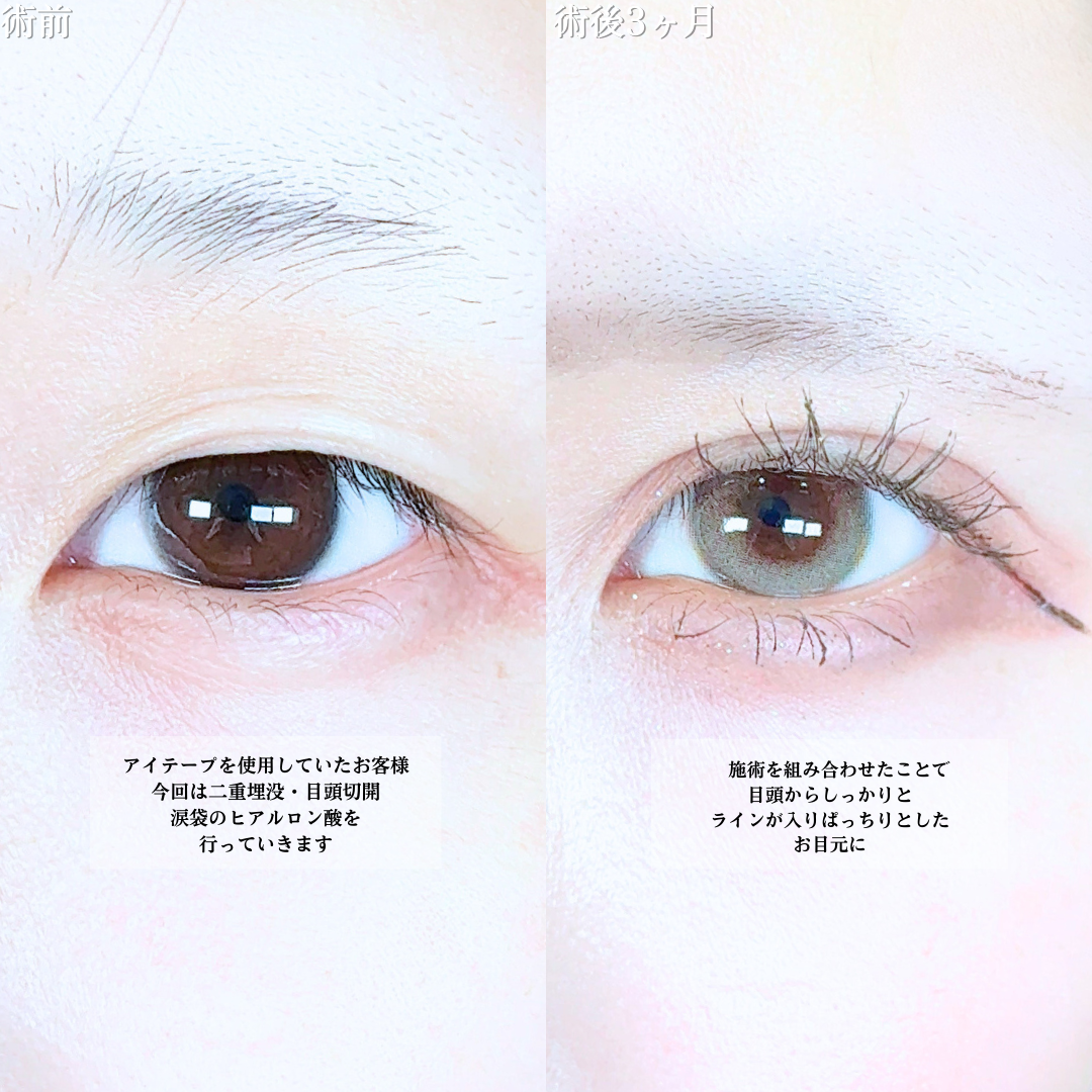 No.19864の症例写真1