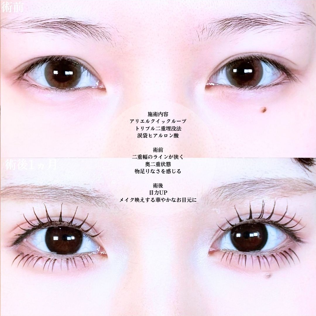 No.20076の症例写真1