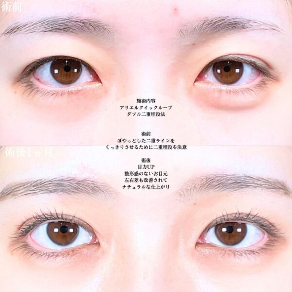 No.20122の症例写真