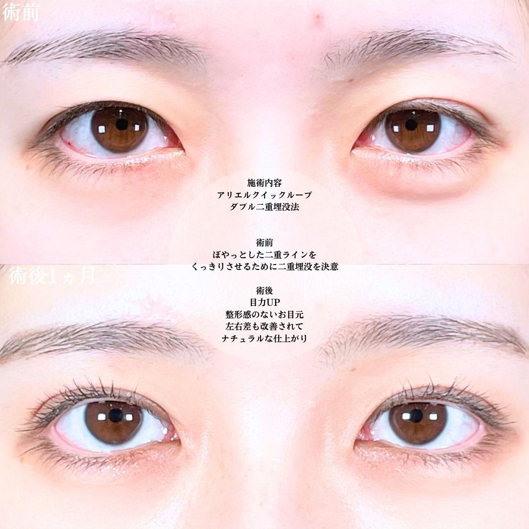 No.20122の症例写真