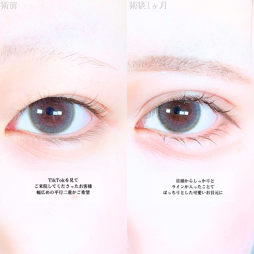 No.19958の症例写真1