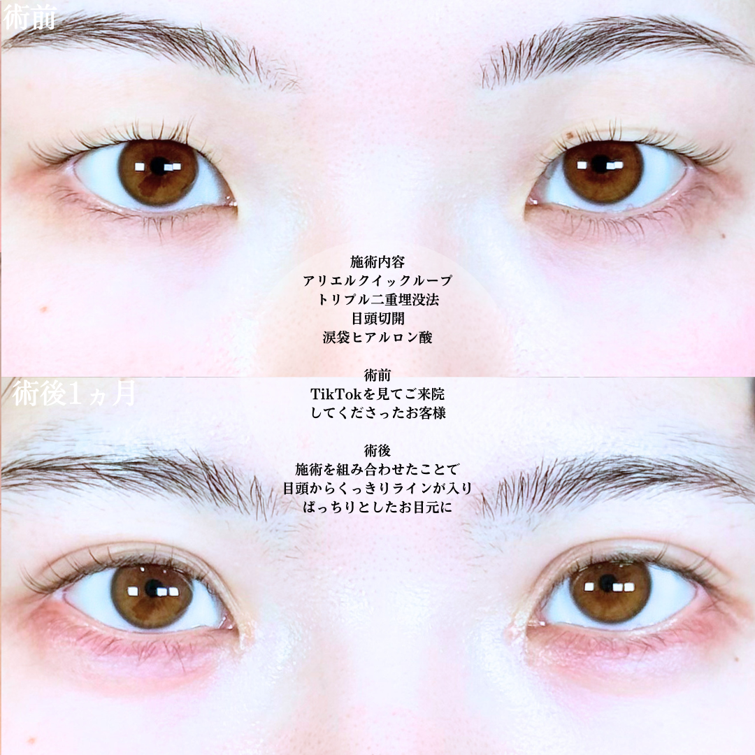 No.19964の症例写真1