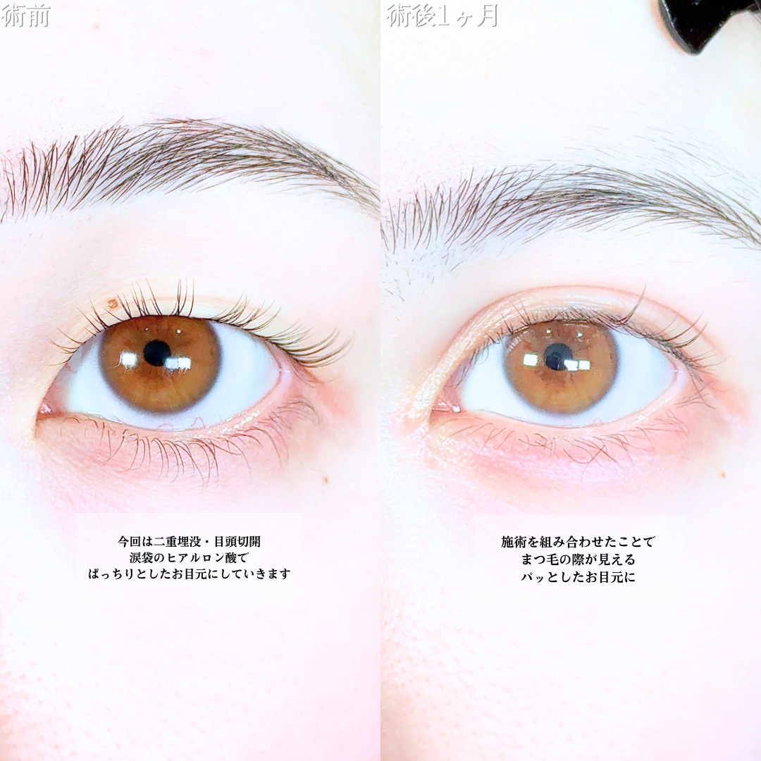 No.20098の症例写真1