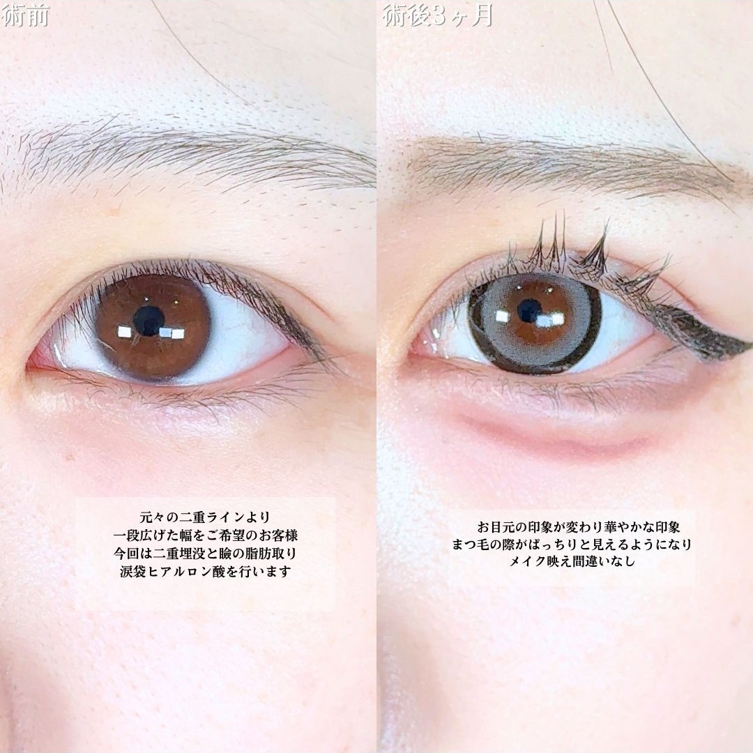 No.19840の症例写真1