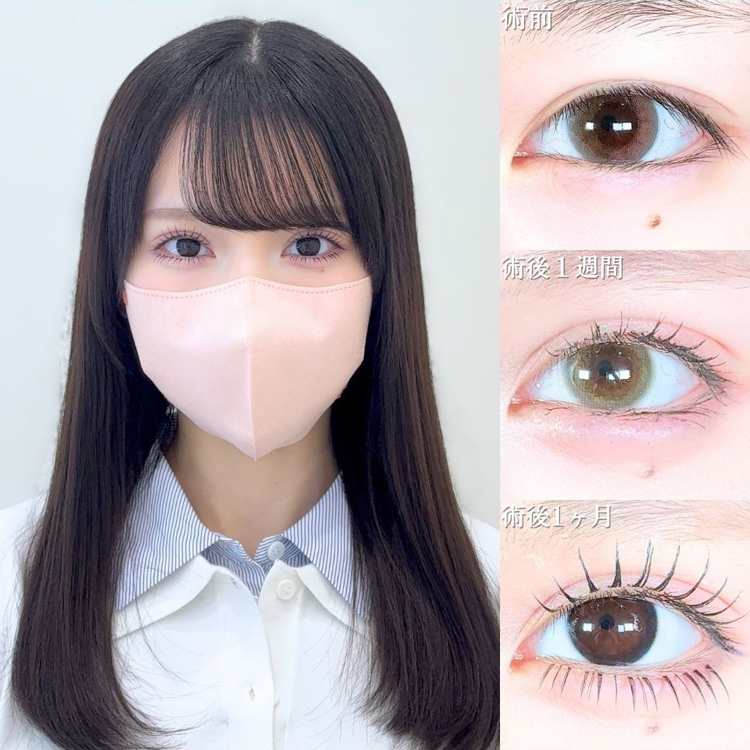 No.20045の症例写真