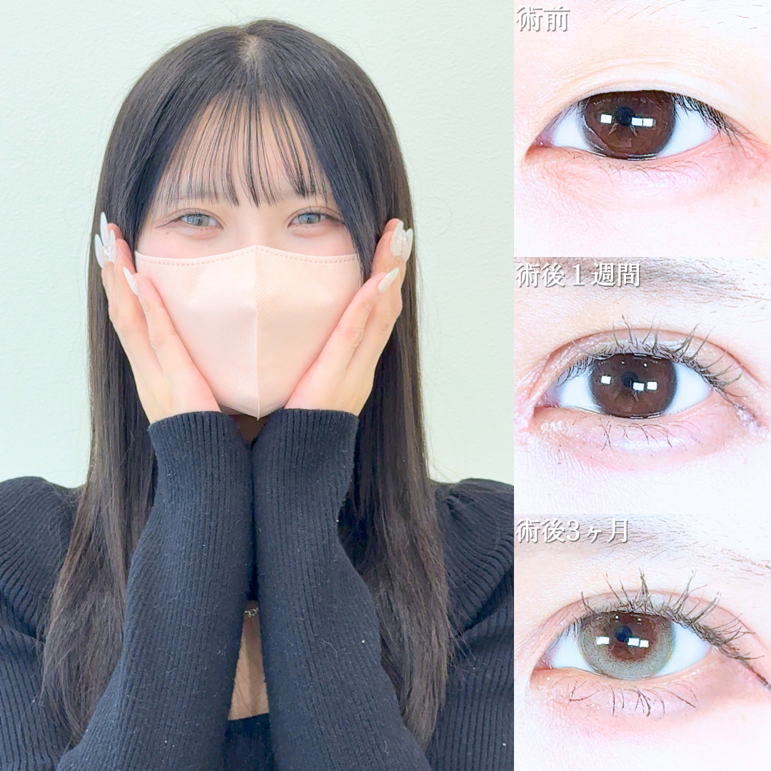 No.19864の症例写真