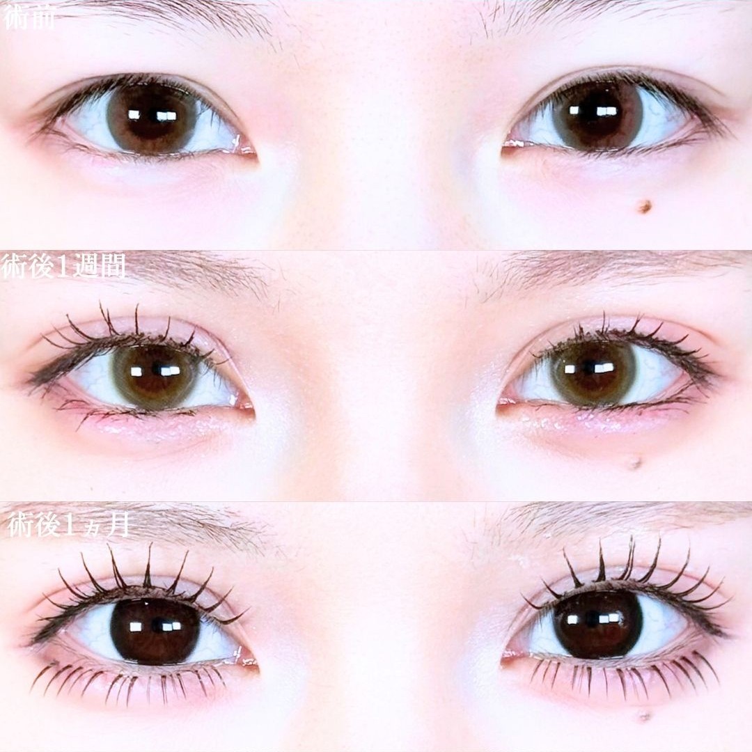 No.20076の症例写真