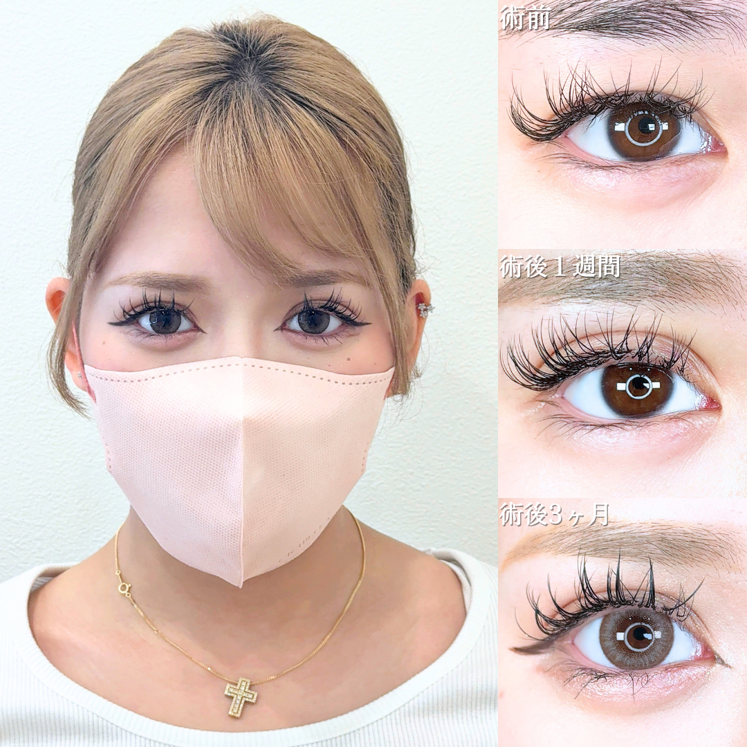 No.19887の症例写真