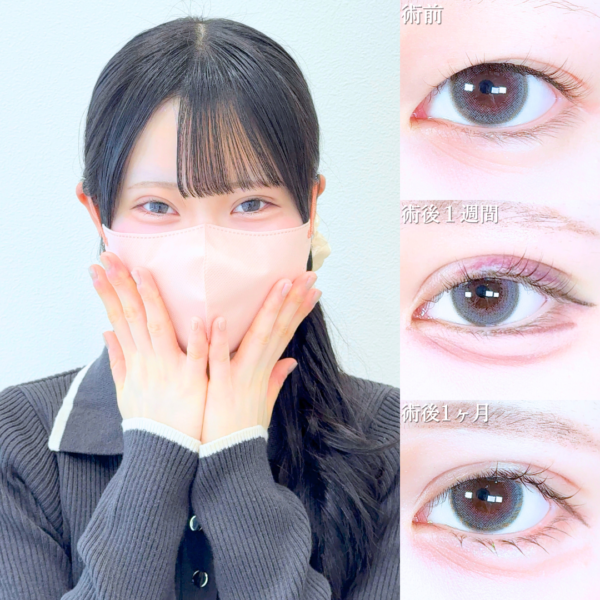 No.19958の症例写真