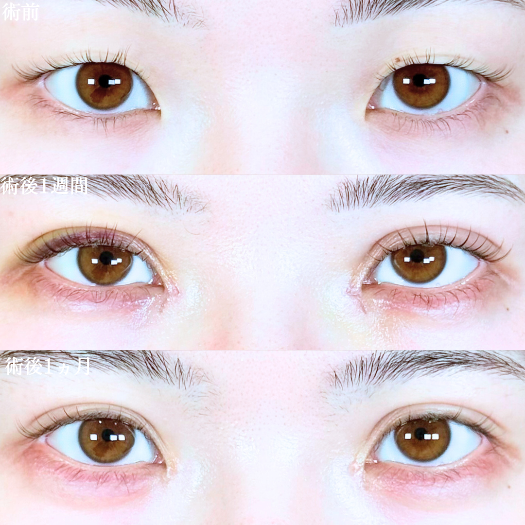 No.19964の症例写真