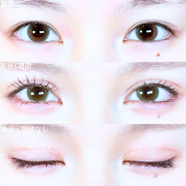 No.19766の症例写真