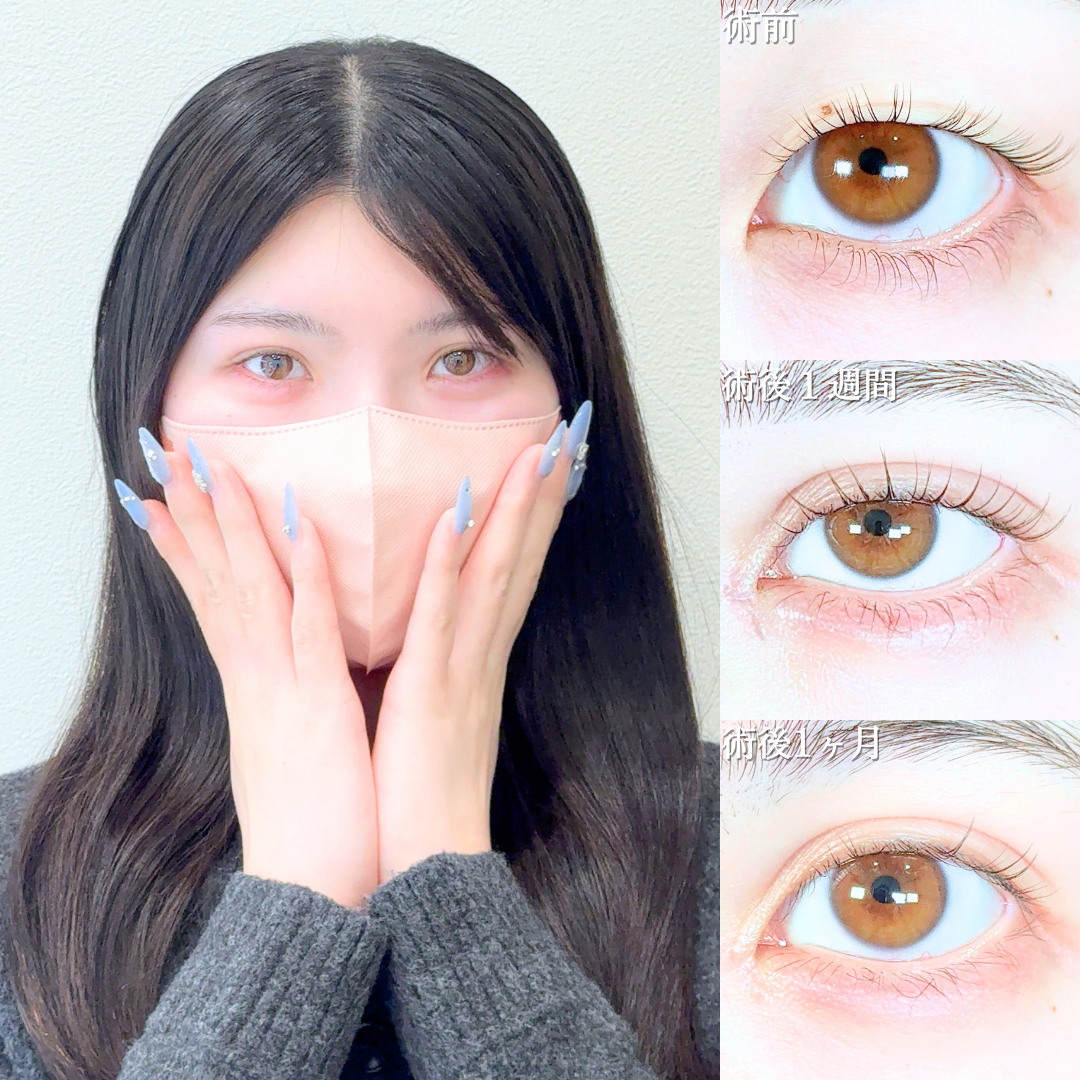 No.20098の症例写真