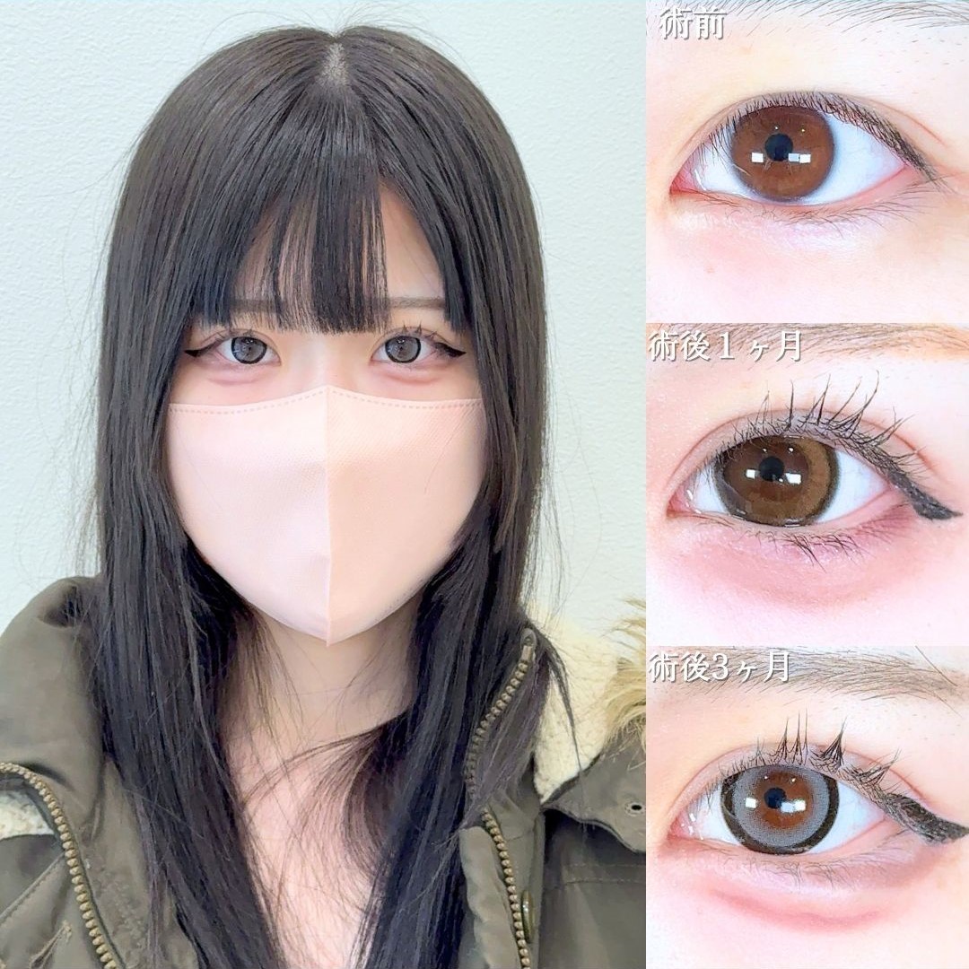 No.19840の症例写真