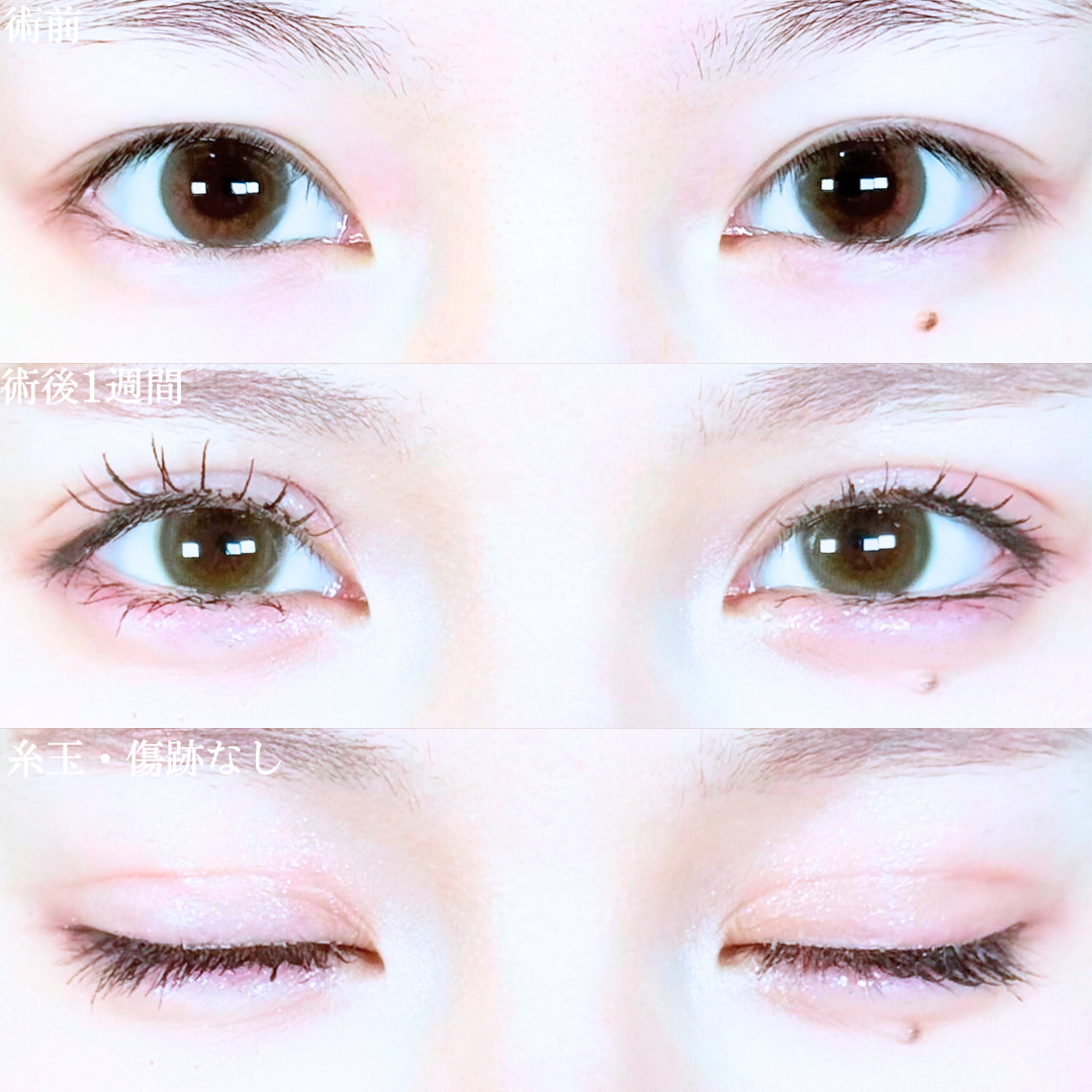 No.19766の症例写真