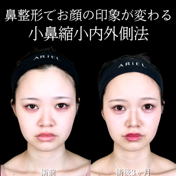 No.19846の症例写真