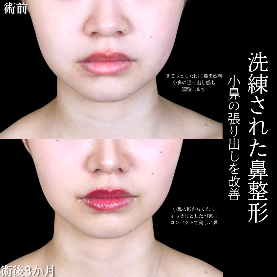 No.19846の症例写真1