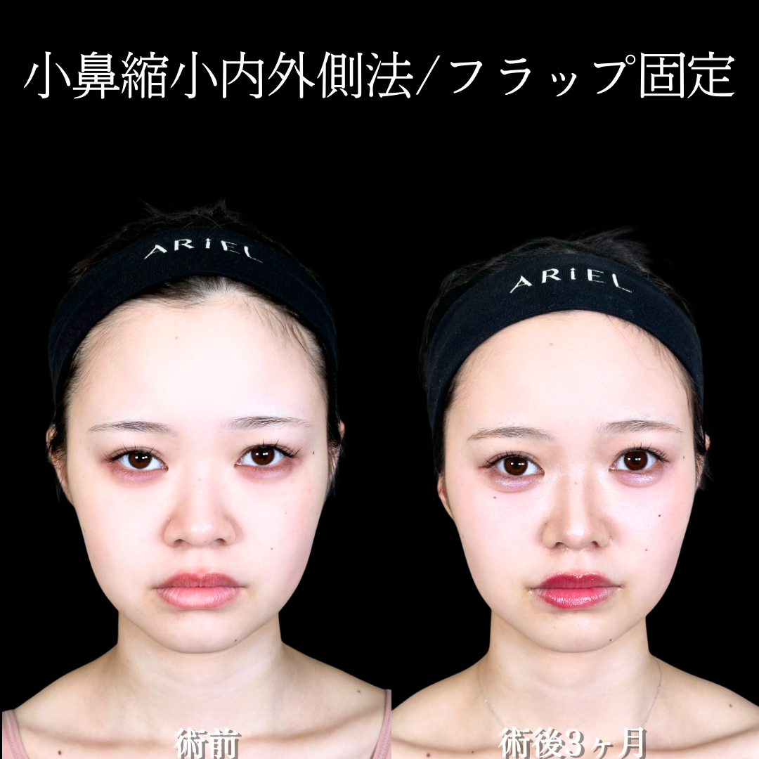 No.19846の症例写真2