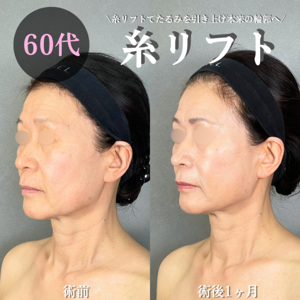 No.20159の症例写真 No.20159の症例写真