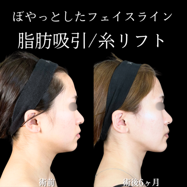 No.20283の症例写真