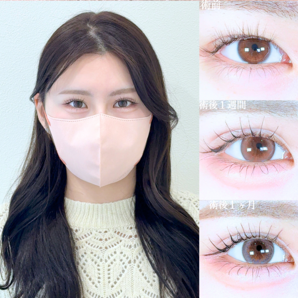 No.20302の症例写真