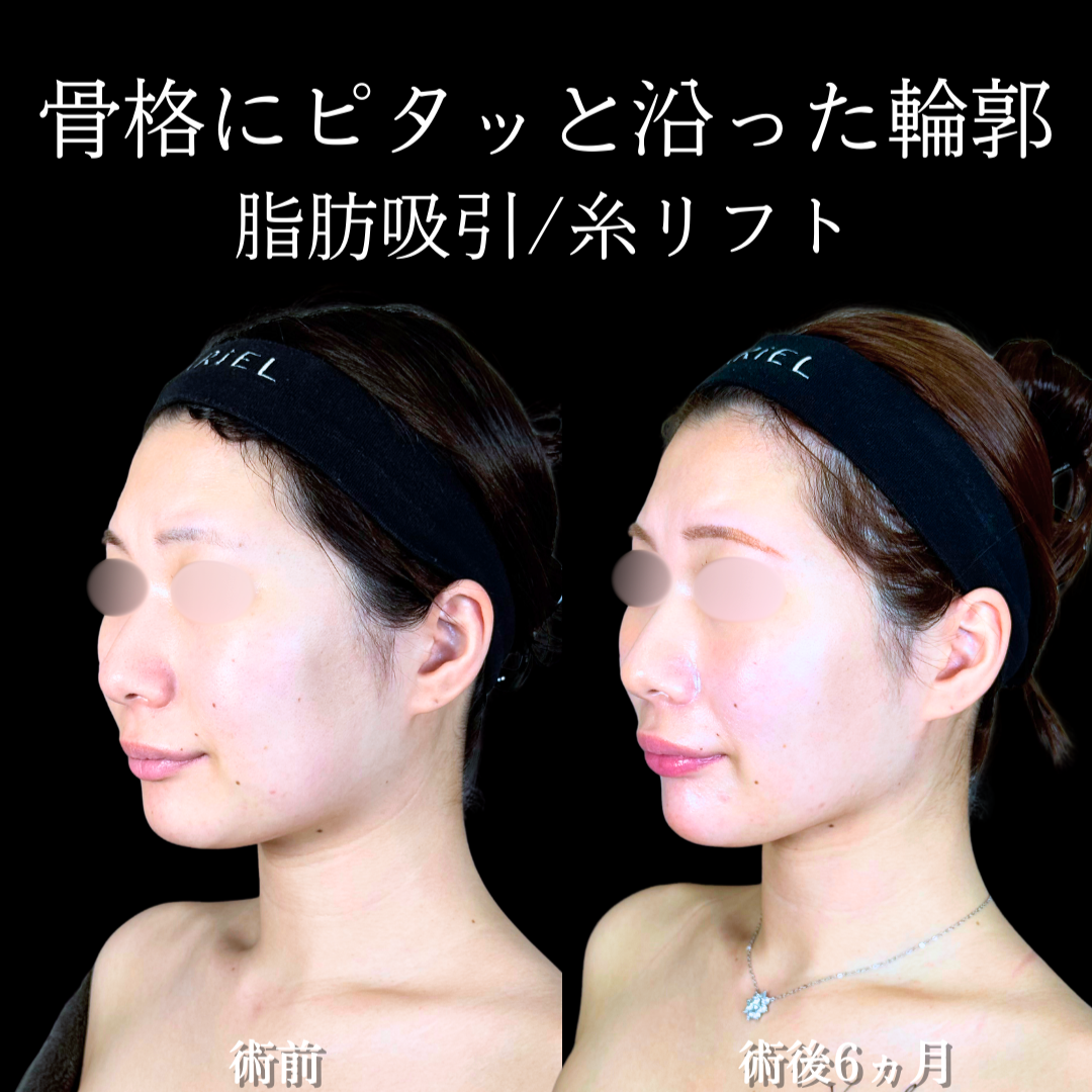 No.20332の症例写真