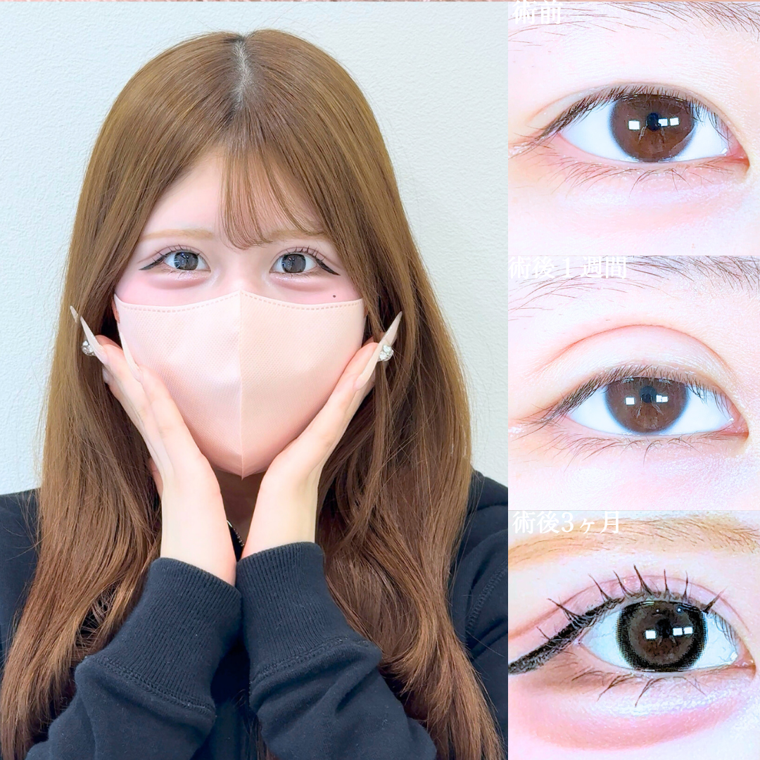 No.20358の症例写真