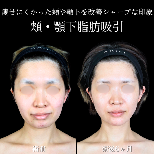 No.20367の症例写真