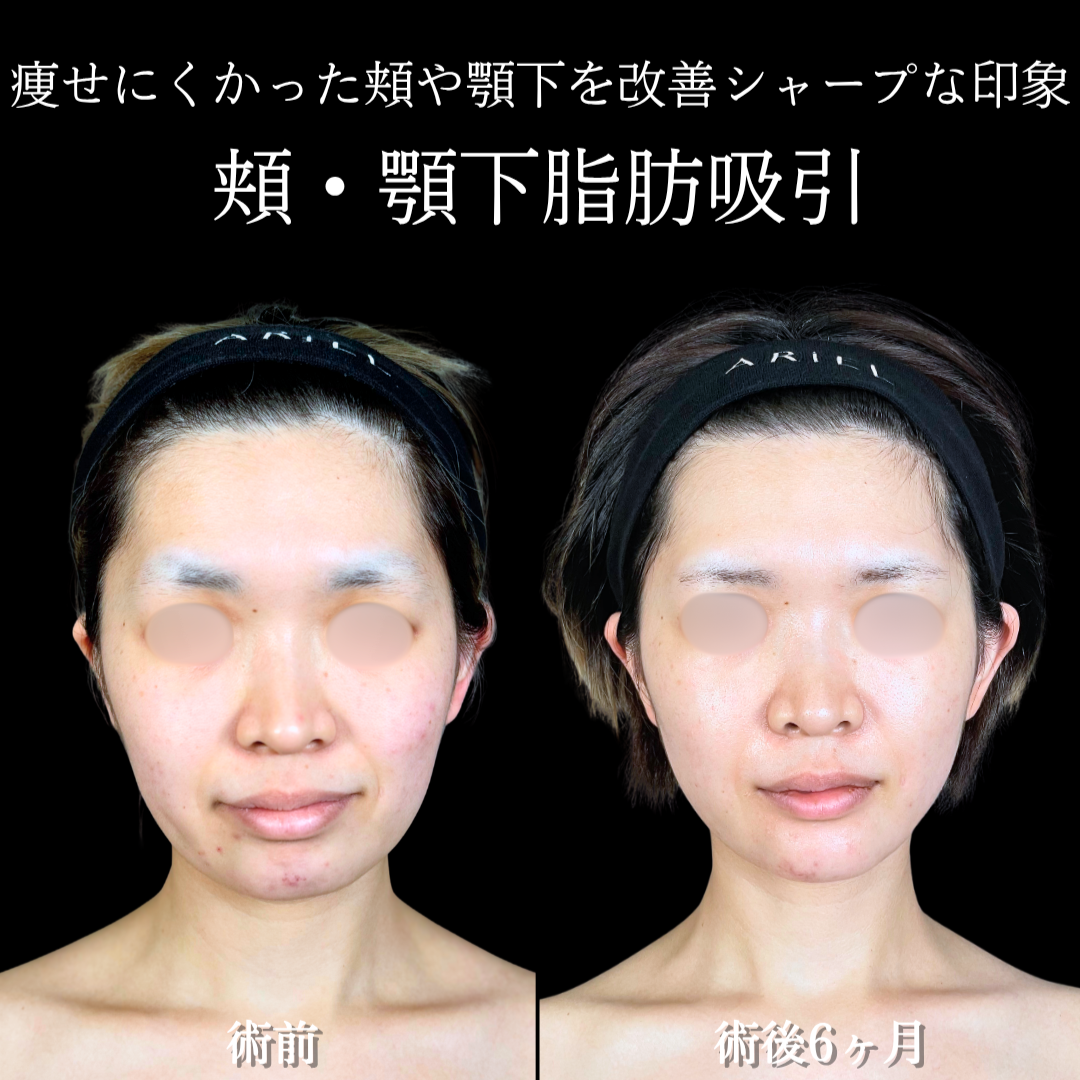 No.20367の症例写真