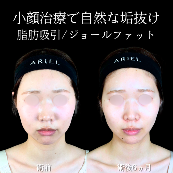 No.20368の症例写真