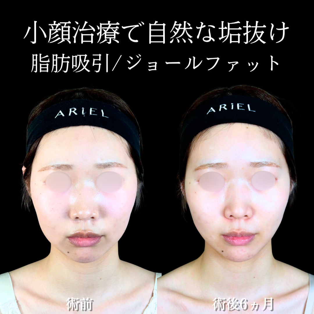 No.20368の症例写真