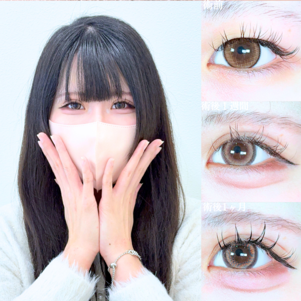 No.20469の症例写真