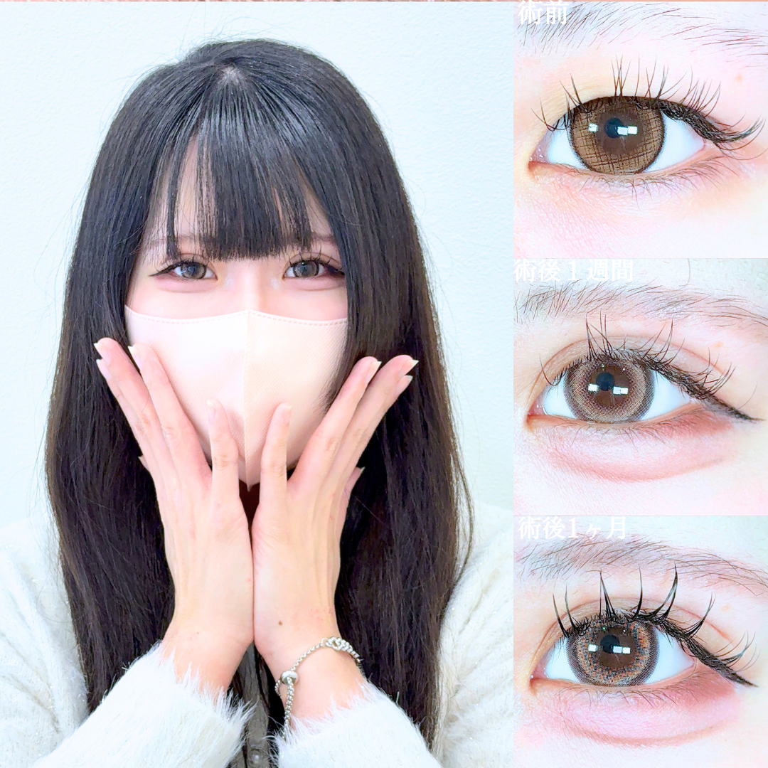 No.20469の症例写真