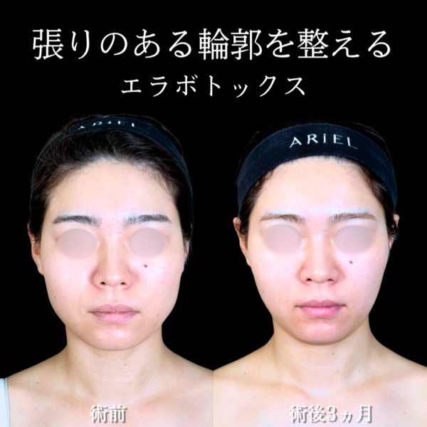 No.20476の症例写真