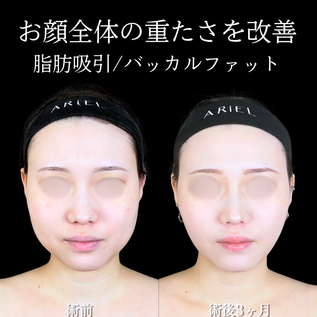 No.20485の症例写真