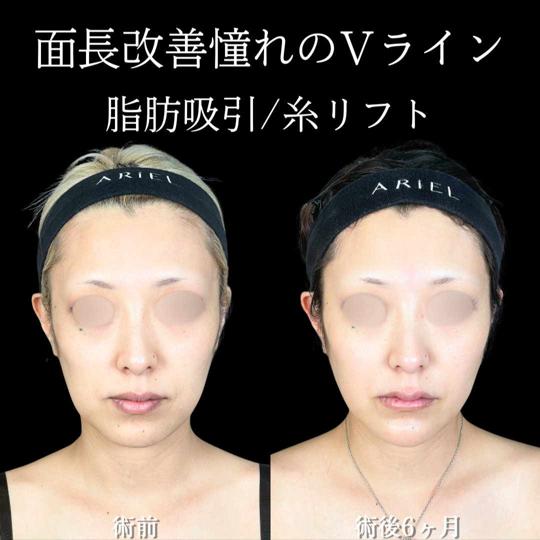 No.20174の症例写真