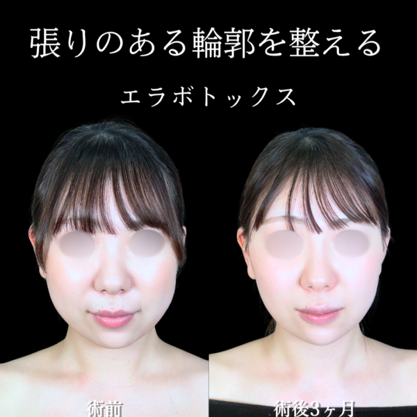 No.20524の症例写真