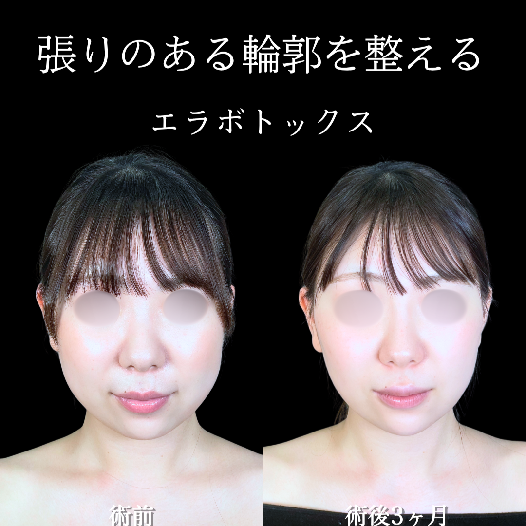 No.20524の症例写真